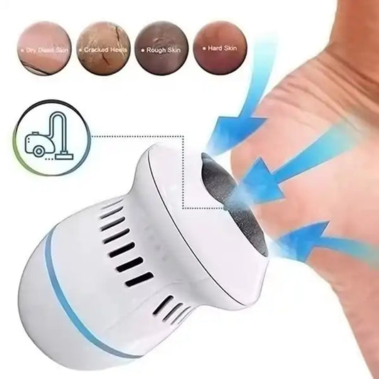 Turpija za pete i stopala električna